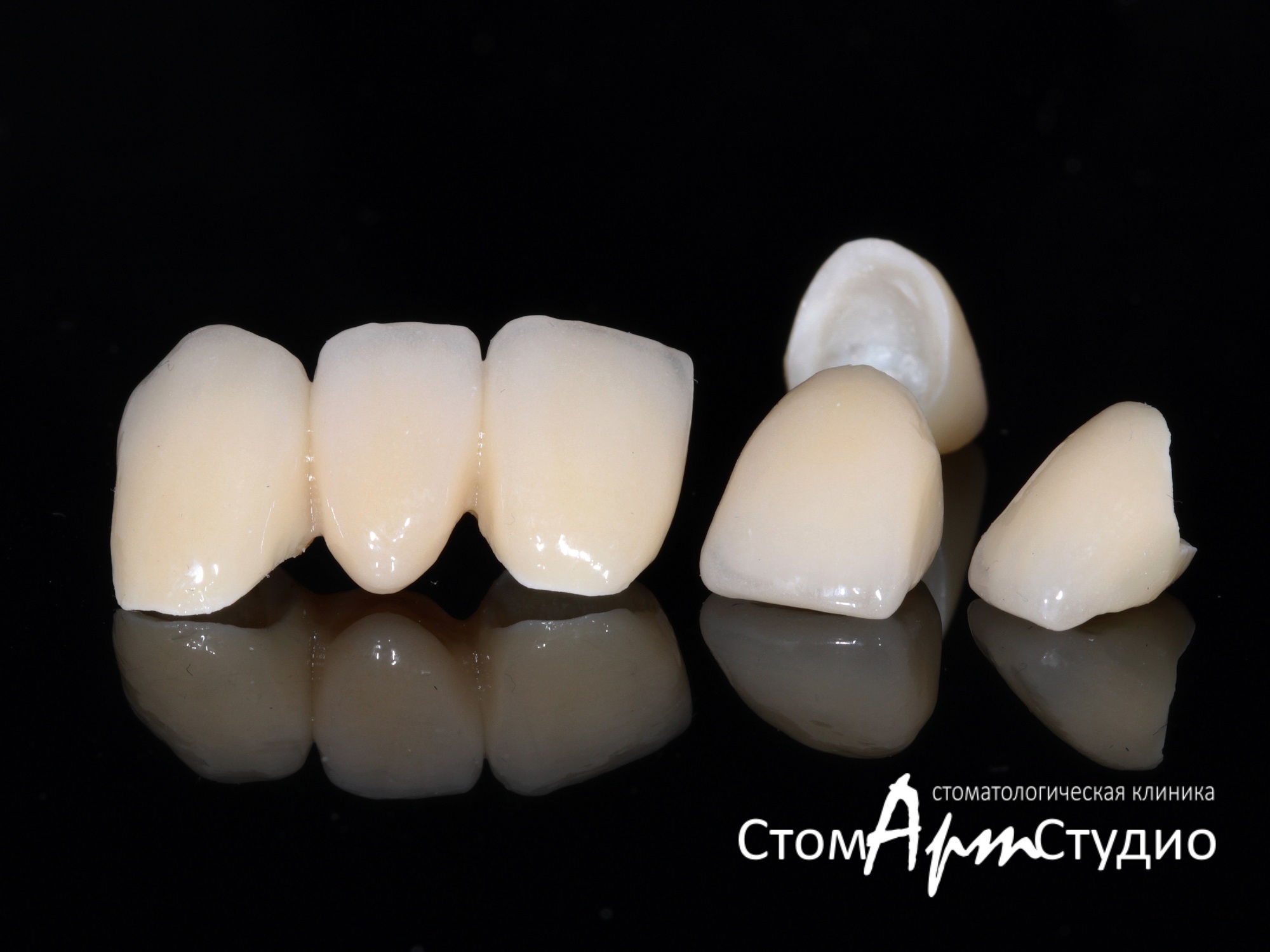 КОРОНКИ НА ЗУБЫ