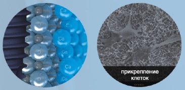 Зубные импланты AnyRidge (Эниридж)