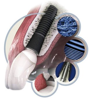 Зубные импланты Astra Tech