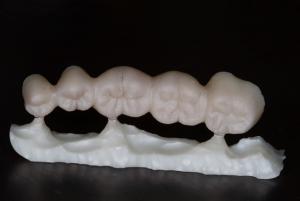 Диоксид циркония.